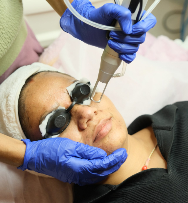 gfc-and-prp-hair-treatment-in-hyderabad-koniki-luxe