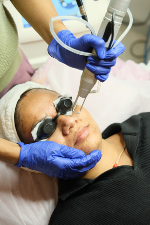 gfc-and-prp-hair-treatment-in-hyderabad-koniki-luxe-big-0